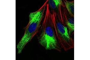 Immunofluorescence analysis of Hela cells using ZEB1 mouse mAb (green). (ZEB1 anticorps  (AA 967-1108))