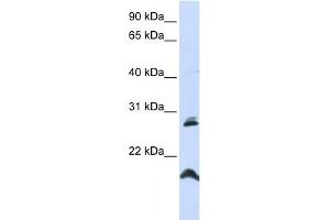 WB Suggested Anti-SPATA9 Antibody Titration:  0. (SPATA9 anticorps  (N-Term))