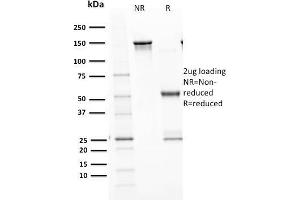 SDS-PAGE Analysis Purified p53 Recombinant Rabbit Monoclonal Antibody (TP53/1799R).