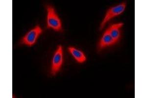 Immunofluorescent analysis of XPLN staining in MCF7 cells.