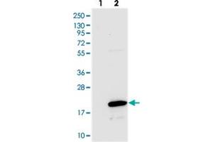 Western blot analysis of Lane 1: Negative control (vector only transfected HEK293T lysate), Lane 2: Over-expression Lysate (Co-expressed with a C-terminal myc-DDK tag (~3. (C11ORF45 anticorps)