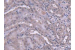 DAB staining on IHC-P; Samples: Rat Kidney Tissue (HEXB anticorps  (AA 100-216))