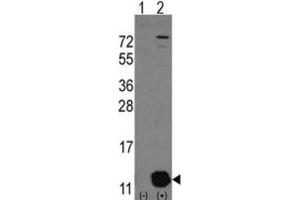 Western Blotting (WB) image for anti-phosphohistidine Phosphatase 1 (PHPT1) antibody (ABIN3001581)