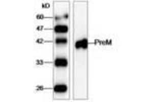 Image no. 1 for anti-West Nile Virus (WNV) (AA 1-135) antibody (ABIN791628) (West Nile Virus anticorps  (AA 1-135))