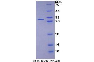 SDS-PAGE analysis of Human Fibulin 1 Protein. (Fibulin 1 Protein (FBLN1))