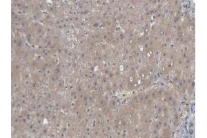 Detection of AST in Human Liver Tissue using Polyclonal Antibody to Aspartate Aminotransferase (AST)