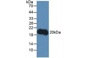 Detection of IL10 in Rat Lymphocytes Cells using Polyclonal Antibody to Interleukin 10 (IL10)