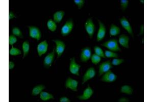 Immunofluorescence staining of A549 cells with ABIN7151037 at 1:166, counter-stained with DAPI. (HECW2 anticorps  (AA 495-641))