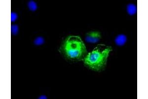 Anti-KRT8 mouse monoclonal antibody (ABIN2452349) immunofluorescent staining of COS7 cells transiently transfected by pCMV6-ENTRY KRT8 (RC209570). (KRT8 anticorps  (AA 91-381))