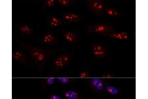 Confocal immunofluorescence analysis of U2OS cells using NOP58 Polyclonal Antibody at dilution of 1:100. (NOP58 anticorps)