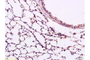 Formalin-fixed and paraffin embedded rat lung labeled with Anti phospho-Src(Tyr418) Polyclonal Antibody, Unconjugated (ABIN746153) at 1:200 followed by conjugation to the secondary antibody and DAB staining (Src anticorps  (pTyr418))