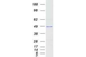 Validation with Western Blot