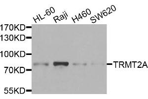 Western blot analysis of extracts of various cells, using TRMT2A antibody. (TRMT2A anticorps)