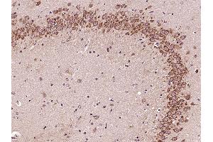 Paraformaldehyde-fixed, paraffin embedded Rat brain Antigen retrieval by boiling in sodium citrate buffer (pH6.