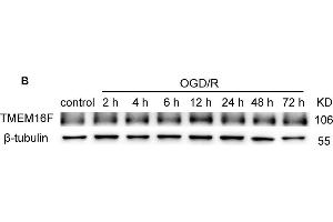 TMEM16F protein level increases after ischemic insult.