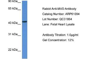 Western Blotting (WB) image for anti-Mevalonate (Diphospho) Decarboxylase (MVD) (N-Term) antibody (ABIN2774304) (MVD anticorps  (N-Term))