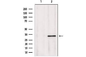 Western blot analysis of extracts from Mouse Myeloma cell, using PYCR1 antibody. (PYCR1 anticorps  (Internal Region))