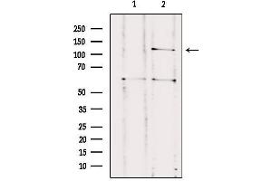 Western blot analysis of extracts from HUVEC, using CNTNAP3 Antibody. (CNTNAP3 anticorps  (Internal Region))