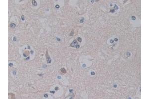 Detection of PTF1a in Human Cerebrum Tissue using Polyclonal Antibody to Pancreas Specific Transcription Factor 1a (PTF1a)