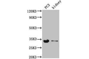 Western Blot Positive WB detected in: PC-3 whole cell lysate, Mouse kidney tissue All lanes: POLR2C antibody at 3. (POLR2C anticorps  (AA 2-275))