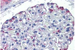 Human Kidney: Formalin-Fixed, Paraffin-Embedded (FFPE)