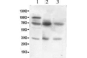 Western Blotting (WB) image for anti-Glutamate Decarboxylase 1 (Brain, 67kDa) (GAD1) (AA 14-122) antibody (ABIN3042415) (GAD anticorps  (AA 14-122))