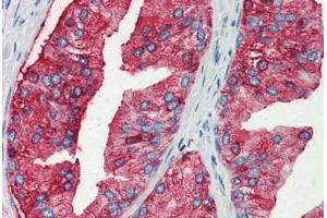 Human Prostate (formalin-fixed, paraffin-embedded) stained with MUC13 antibody ABIN351431 at 10 ug/ul followed by biotinylated goat anti-rabbit IgG secondary antibody ABIN481713, alkaline phosphatase-streptavidin and chromogen. (MUC13 anticorps  (Internal Region))