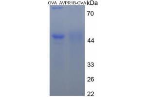 Image no. 1 for Arginine Vasopressin Receptor 1B (AVPR1B) peptide (Ovalbumin) (ABIN5666088) (Arginine Vasopressin Receptor 1B (AVPR1B) peptide (Ovalbumin))