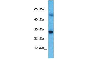Host:  Rabbit  Target Name:  NKX6-3  Sample Type:  Esophagus Tumor lysates  Antibody Dilution:  1. (NK6 Homeobox 3 anticorps  (C-Term))