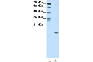 WB Suggested Anti-DUX5 Antibody Titration:  5. (DUX5 anticorps  (C-Term))