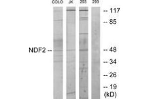 Western blot analysis of extracts from 293/COLO/Jurkat cells, using NDF2 Antibody. (NEUROD2 anticorps  (AA 61-110))