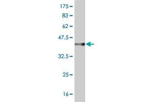 Western Blot detection against Immunogen (37. (RASA3 anticorps  (AA 725-834))