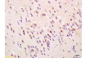 Formalin-fixed and paraffin embedded rat brain labeled with Rabbit Anti FGF1/AFGF Polyclonal Antibody, Unconjugated (ABIN726590) at 1:200 followed by conjugation to the secondary antibody and DAB staining (FGF1 anticorps  (AA 16-80))