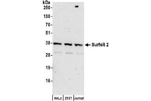Western Blotting (WB) image for anti-Surfeit 2 (SURF2) (AA 175-225) antibody (ABIN7450790)