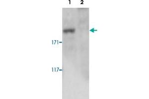 Western blot was performed on whole cell lysates from mouse fibroblasts (Lane 1, NIH/3T3) and embryonic stem cells (Lane 2, E14Tg2a) with Setd1a polyclonal antibody , diluted 1 : 500 in BSA/PBS-Tween. (SETD1A anticorps)