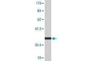 Western Blot detection against Immunogen (36. (INPP1 anticorps  (AA 300-399))