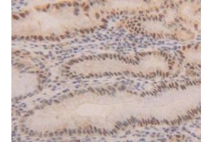 Detection of PCNA in Human Stomach Tissue using Polyclonal Antibody to Proliferating Cell Nuclear Antigen (PCNA) (PCNA anticorps  (AA 6-261))
