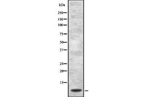 Western blot analysis of Defensin alpha1 using Jurkat whole cell lysates (alpha Defensin 1 anticorps)