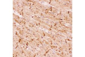 Anti-Desmin Picoband antibody,  IHC(F): Mouse Cardiac Muscle Tissue