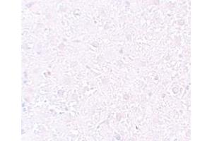 Immunohistochemistry (IHC) image for anti-Mesenchyme Homeobox 1 (MEOX1) (Middle Region) antibody (ABIN1031005)