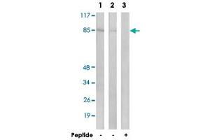 Western blot analysis of extracts from LoVo cells (Lane 1 and lane 3) and K-562 cells (Lane 2), using CHPF polyclonal antibody . (CHPF anticorps)