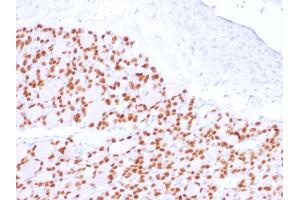 Formalin-fixed, paraffin-embedded human Thyroid stained with PAX8 Recombinant Rabbit Monoclonal Antibody (PAX8/2774R).