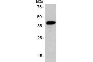 Western blot analysis of ARPP expression in TE-1 using AM26555AF-N. (ANKRD2 anticorps)