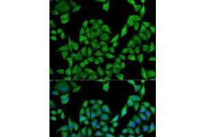 Immunofluorescence analysis of U2OS cells using UGT1A1 Polyclonal Antibody