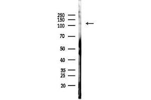 anti-IWS1 Homolog (IWS1) (N-Term) antibody