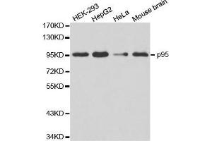 Western blot analysis of extracts of various cell lines, using NBN antibody. (Nibrin anticorps  (AA 435-754))