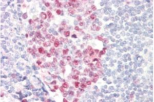 ABIN5539501 (5µg/ml) staining of paraffin embedded Human Tonsil.