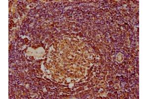 IHC image of ABIN7139928 diluted at 1:300 and staining in paraffin-embedded human lymph node tissue performed on a Leica BondTM system. (MDFIC anticorps  (AA 35-53))