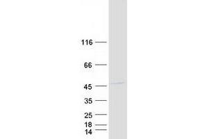 Validation with Western Blot