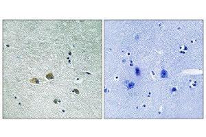 Immunohistochemistry (IHC) image for anti-P21-Activated Kinase 1 (PAK1) (Ser204) antibody (ABIN1848246)